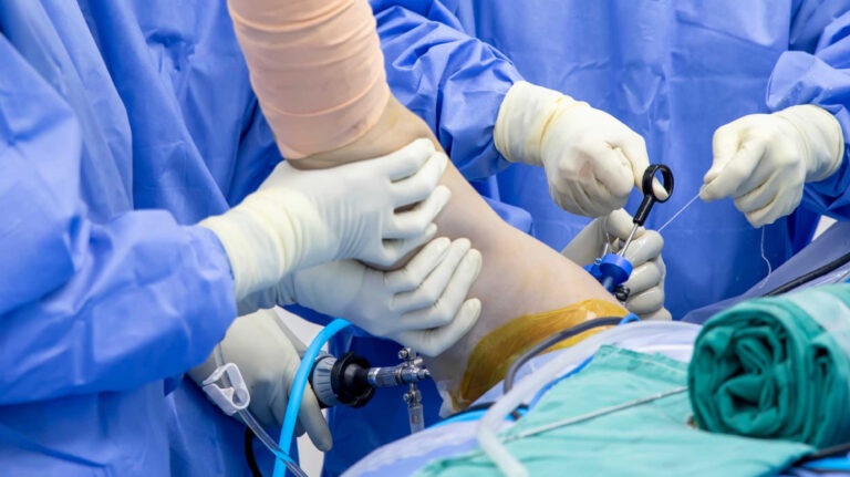 Arthroscopy-Surgery-for-Knee-Shoulder-11